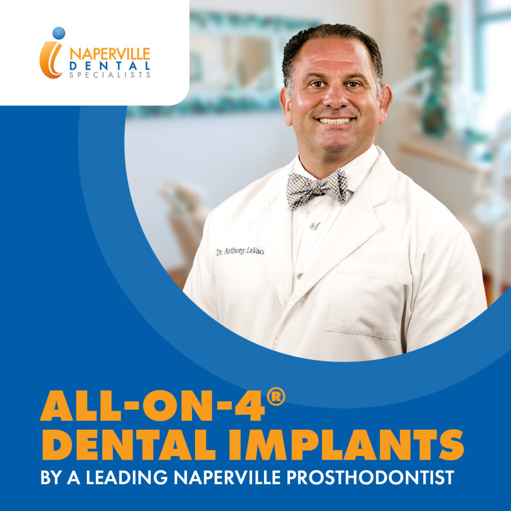A picture of Dr. Anthony LaVacca for a blog post titled, All-on-4 vs. Dentures